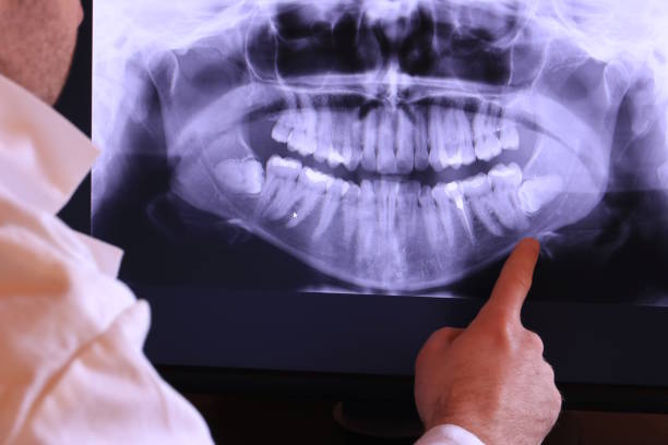 Best Emergency Broken Tooth Repair in Wolverine Lake, MI