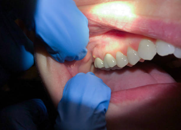 Best Emergency Dental Surgery in Wolverine Lake, MI