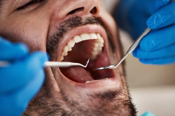 Best Emergency Root Canal Treatment in Wolverine Lake, MI