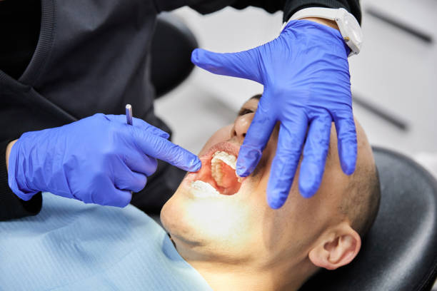 Best Emergency Tooth Extraction in Wolverine Lake, MI