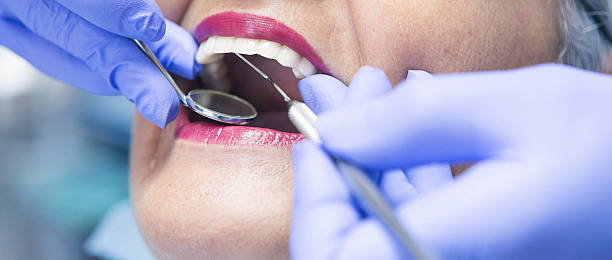 Best Walk-In Emergency Dentist in Wolverine Lake, MI